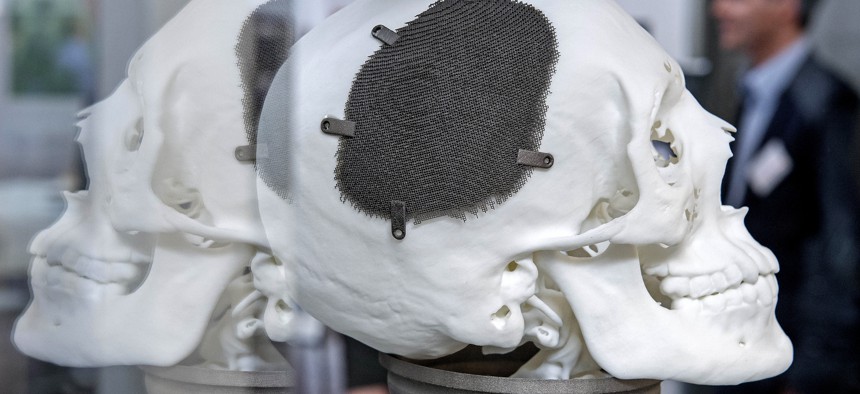 A man stands behind a 3D print of a fully porous titanium grade five cranial implant for a patient.