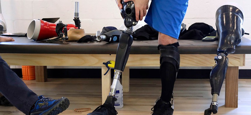 Boston Marathon bombing survivor Marc Fucarile holds his thigh socket as he tests a variety of microprocessor-controlled prosthetic knees, during a visit to the Medical Center Orthotics and Prosthetics in the Allston neighborhood of Boston.