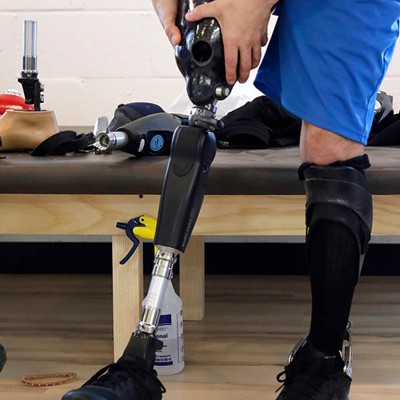 New Device From AT&T Could Help People With Prosthetic Limbs - Nextgov/FCW