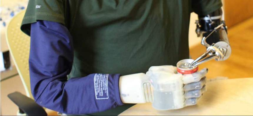 A participant in DARPA's Revolutionizing Prosthetics program tries opening a can.